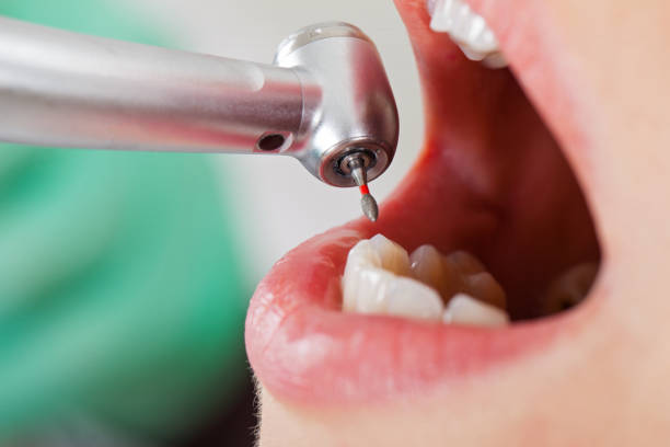 Best Emergency Dental Surgery in Redland, TX